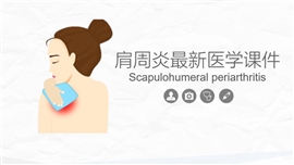 肩周炎最新医学综合知识大全PPT模板